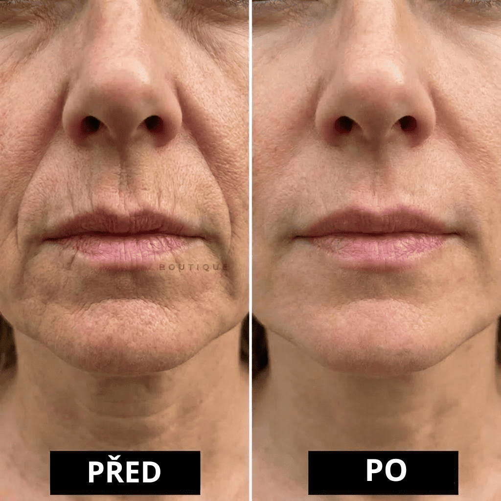 Kolagen-kalciový balzám pro hustotu pleti v  menopauze