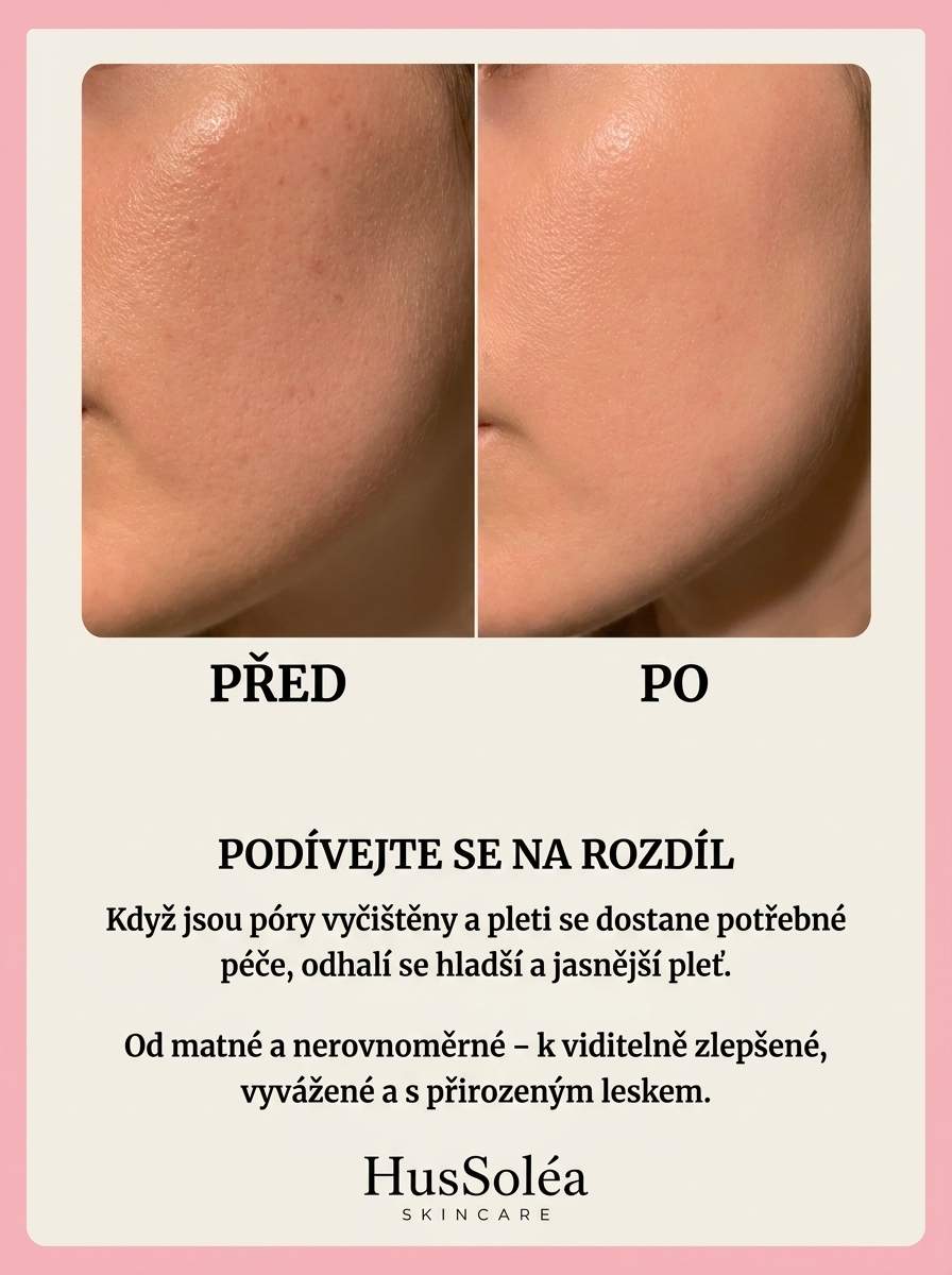 HusSoléa Peel Shot – Sérum z černé rýže proti pórům a mastné pleti