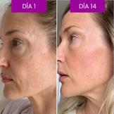 Bálsamo de Colágeno y Calcio para mejorar la firmeza de la piel durante la menopausia.