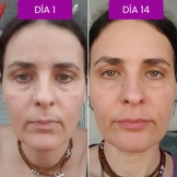 Bálsamo de Colágeno y Calcio para mejorar la firmeza de la piel durante la menopausia.