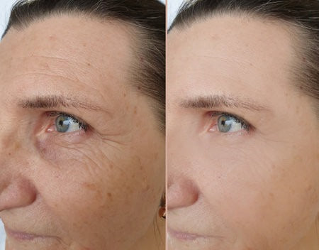 Bálsamo de Colágeno y Calcio para mejorar la firmeza de la piel durante la menopausia.